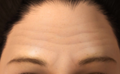 �����ͷ�Ƶ��˻ᾭ��ʲô �������һһ����