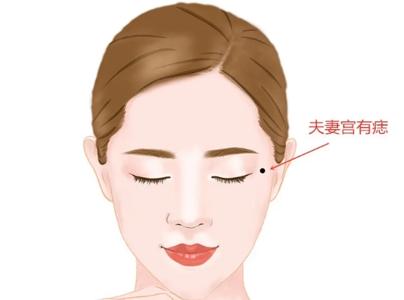 重夫痣和宜夫痣的区别,你分得清楚吗-996手相网